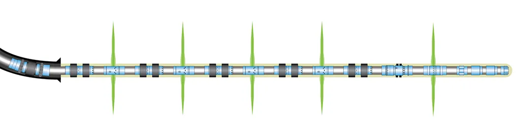 Close-up image of a multi-electrode cardiac catheter used for heart rhythm monitoring and electrophysiology studies.